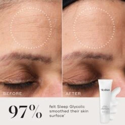 Sleep Glycolic™ -Rimberio Cosmetics 20230922 PDPAsset3 SleepGlycolic B A ROW